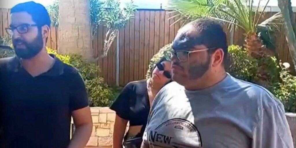 Το ξενοδοχείο θα αναλάβει τη θεραπεία του μάγειρα που κάηκε με λάδι