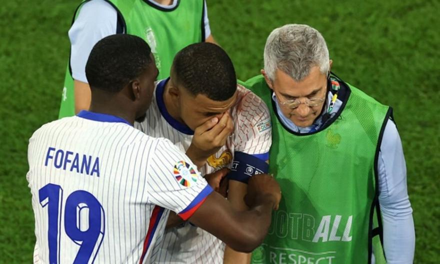 Σοκ στη Γαλλία με Εμπαπέ: Έσπασε τη μύτη του και μπαίνει χειρουργείο – Στον «αέρα» η παρουσία του στο υπόλοιπο Euro!