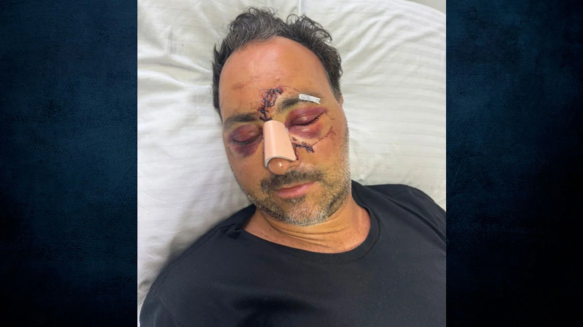 Και τρίτος κατηγορούμενος για τον ξυλοδαρμό του Ελληνοκαναδού