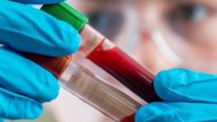 Oι καρκίνοι του αίματος αντιπροσωπεύουν σχεδόν το 10% όλων των νέων διαγνώσεων καρκίνου κάθε χρόνο