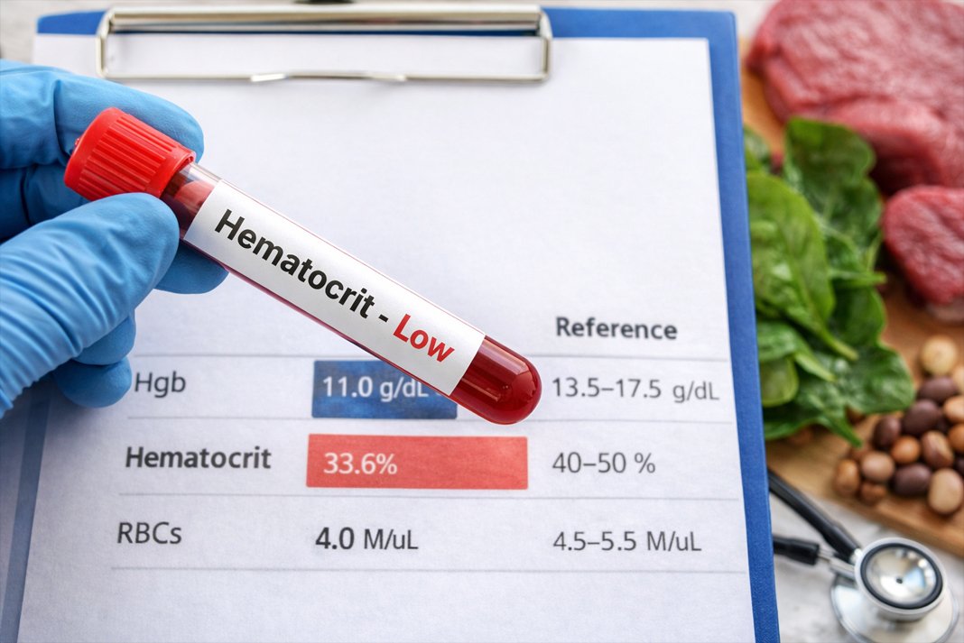Προσοχή στον αιματοκρίτη